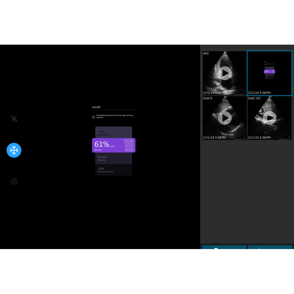 Caption AI™ for Vscan Air™ SL